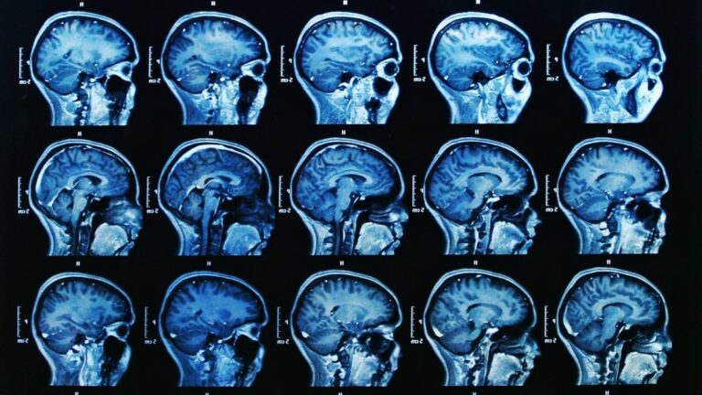 Can This Bizarre Optical Illusion Actually Reveal Your Brain's True Age? (90% Fail By The Third Image)