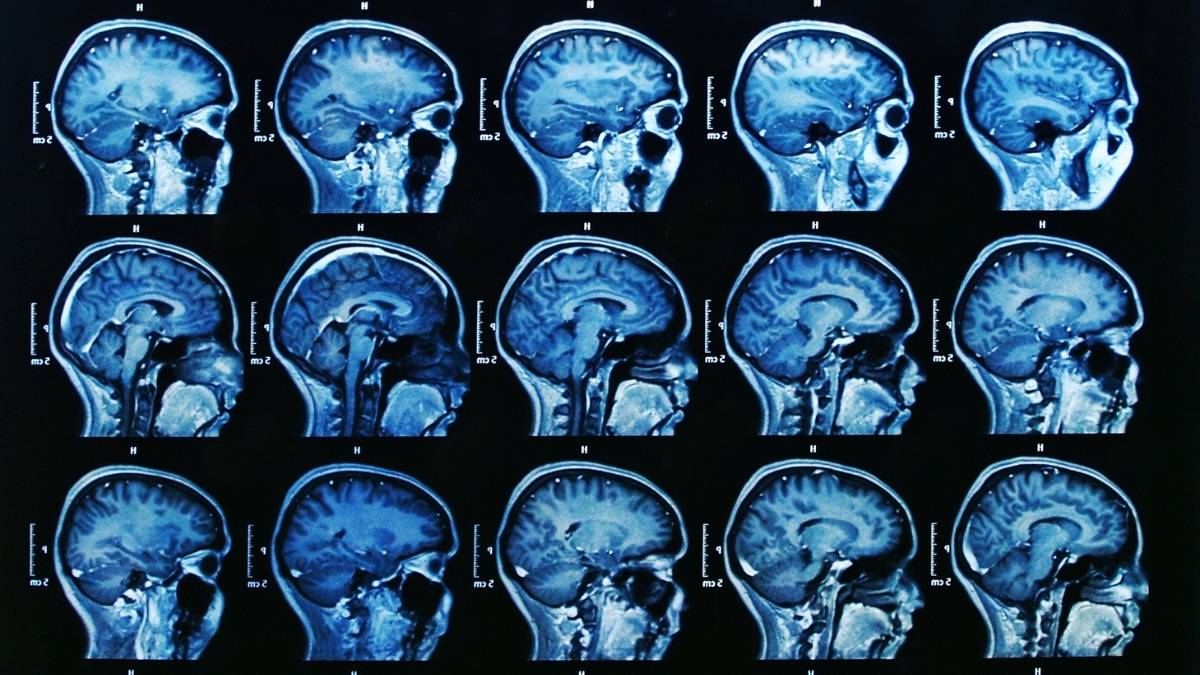 Can This Bizarre Optical Illusion Actually Reveal Your Brain's True Age? (90% Fail By The Third Image)