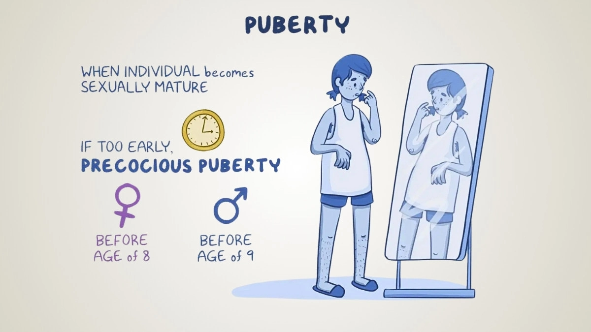 Early Puberty (Precocious Puberty): Why It's on the Rise and How It Affects Final Adult Height
