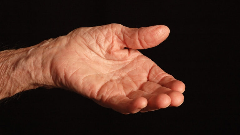 Stop Ignoring Your Hands—Weak Grip Strength Now Predicts Early Mortality